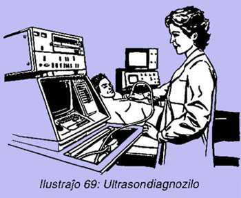 Ultrasondiagnozilo